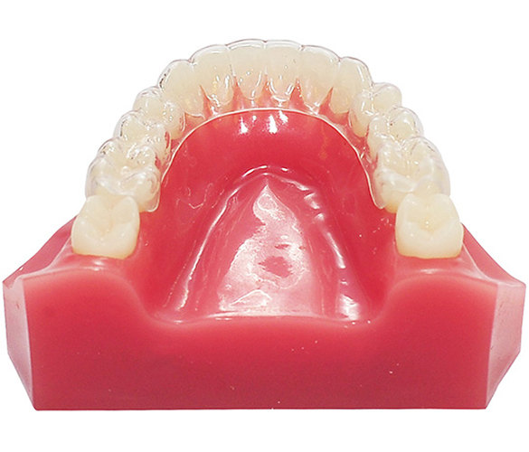 Essix Plus Retainer